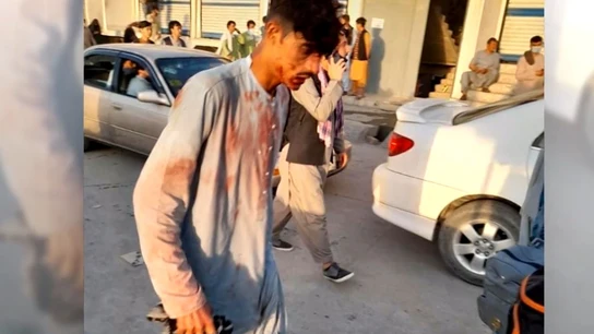 Un hombre herido en el atentado de Kabul. Un hombre herido en el atentado de Kabul.