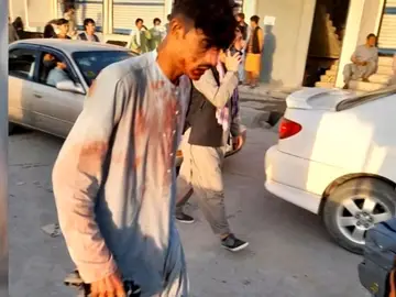 Un hombre herido en el atentado de Kabul.