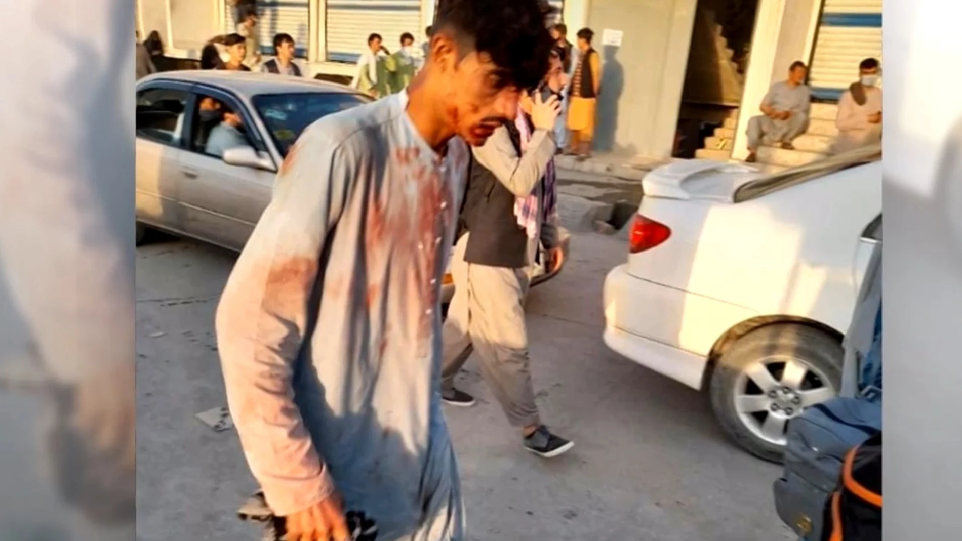 Un hombre herido en el atentado de Kabul.
