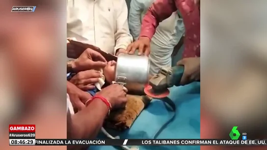El angustioso momento en el que retiran una olla de la cabeza de un niño con una sierra eléctrica El angustioso momento en el que retiran una olla de la cabeza de un niño con una sierra eléctrica