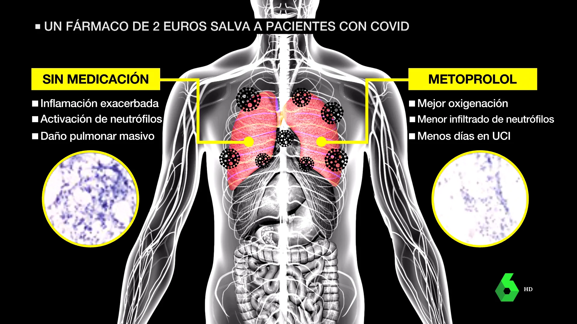 medicamento dos euros