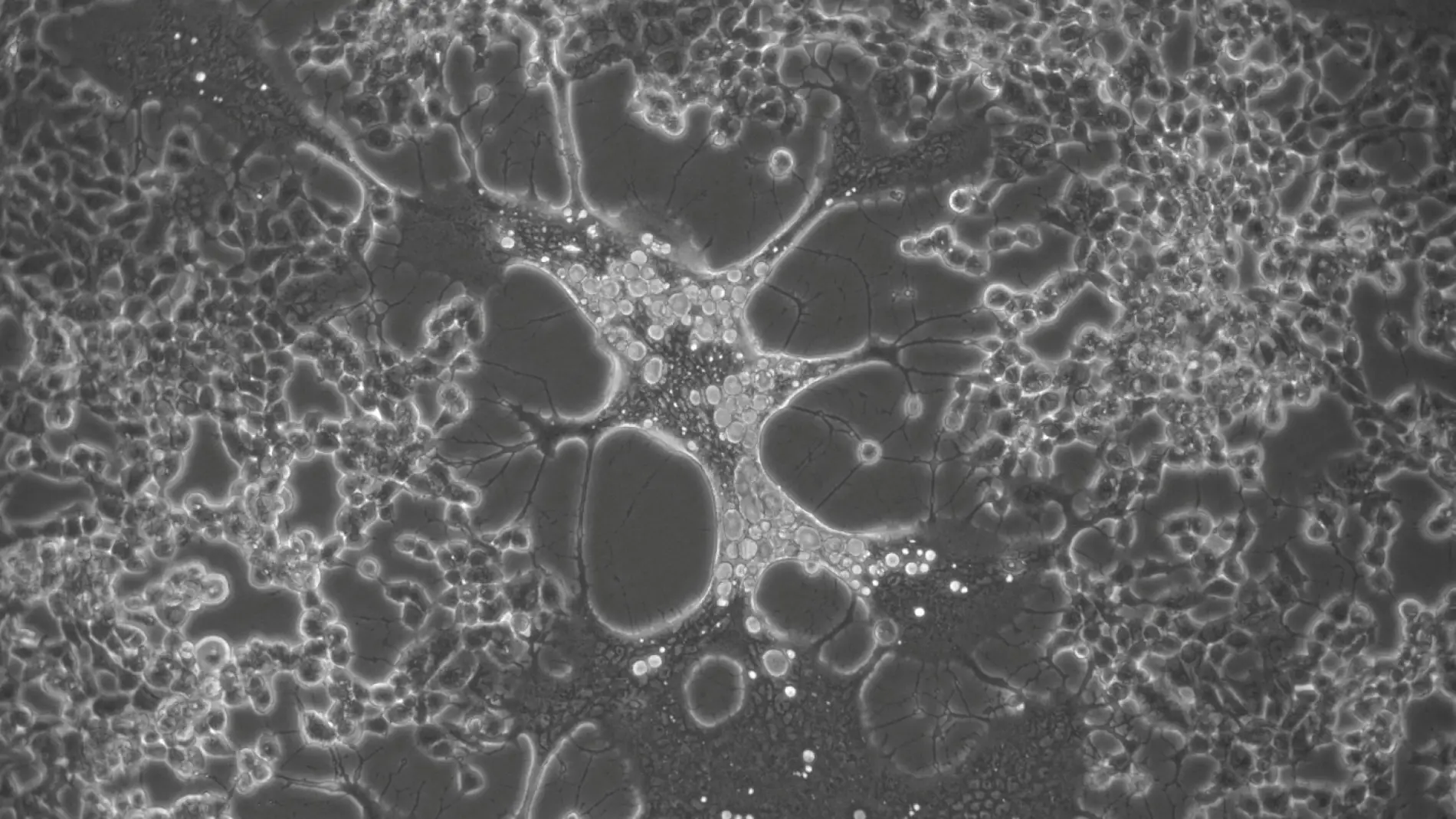 El virus del herpes genital humano evoluciona mas rapido que el labial