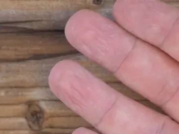 Dedos arrugados Dedos arrugados