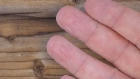 Dedos arrugados Dedos arrugados