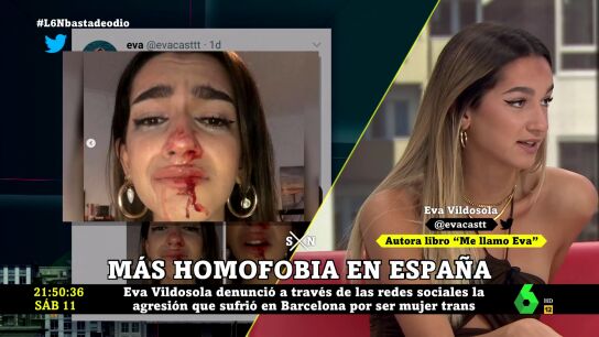 Eva Vildosola, mujer trans: "He vivido agresiones, insultos y acoso y los seguir&eacute; viviendo en cualquier sitio al que vaya"