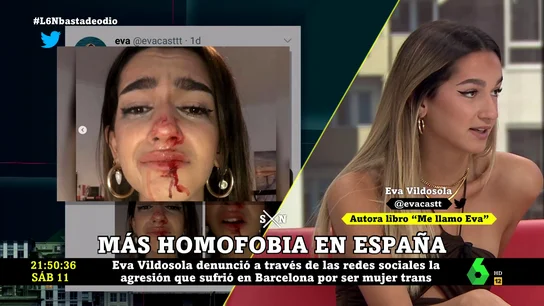 Eva Vildosola, mujer trans: "He vivido agresiones, insultos y acoso y los seguiré viviendo en cualquier sitio al que vaya" Eva Vildosola, mujer trans: "He vivido agresiones, insultos y acoso y los seguiré viviendo en cualquier sitio al que vaya"