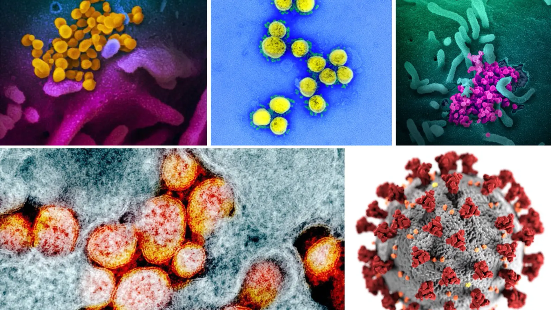 Los medios de comunicacion han embellecido la imagen del coronavirus