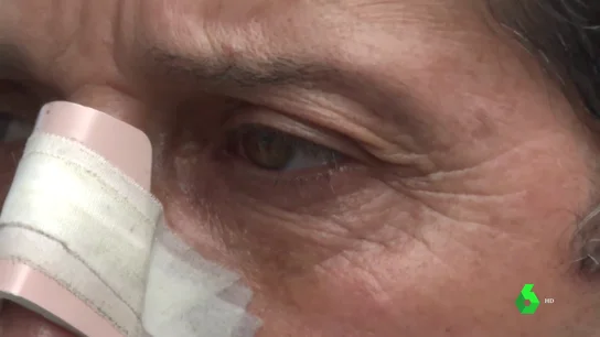 Brutal agresión a un joven con discapacidad en Lugo: Brutal agresión a un joven con discapacidad en Lugo: