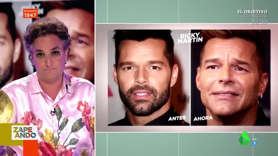 Josie analiza la nueva cara de Ricky Martin Josie analiza la nueva cara de Ricky Martin