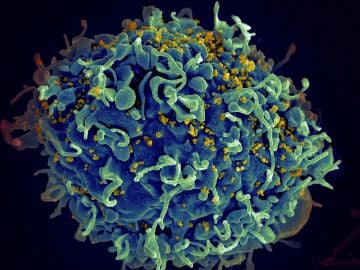 Una célula T (en azul) siendo atacada por el VIH (amarillo)