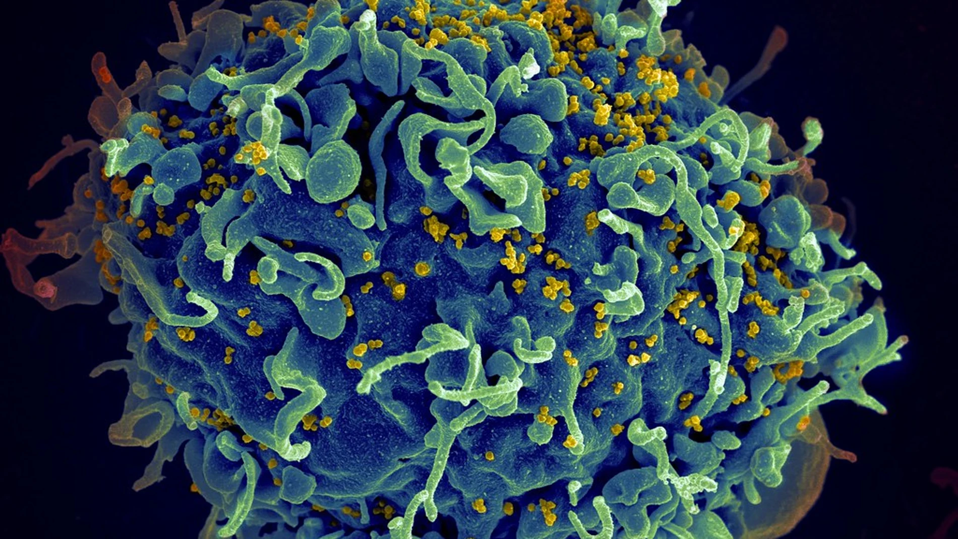 Una célula T (en azul) siendo atacada por el VIH (amarillo)