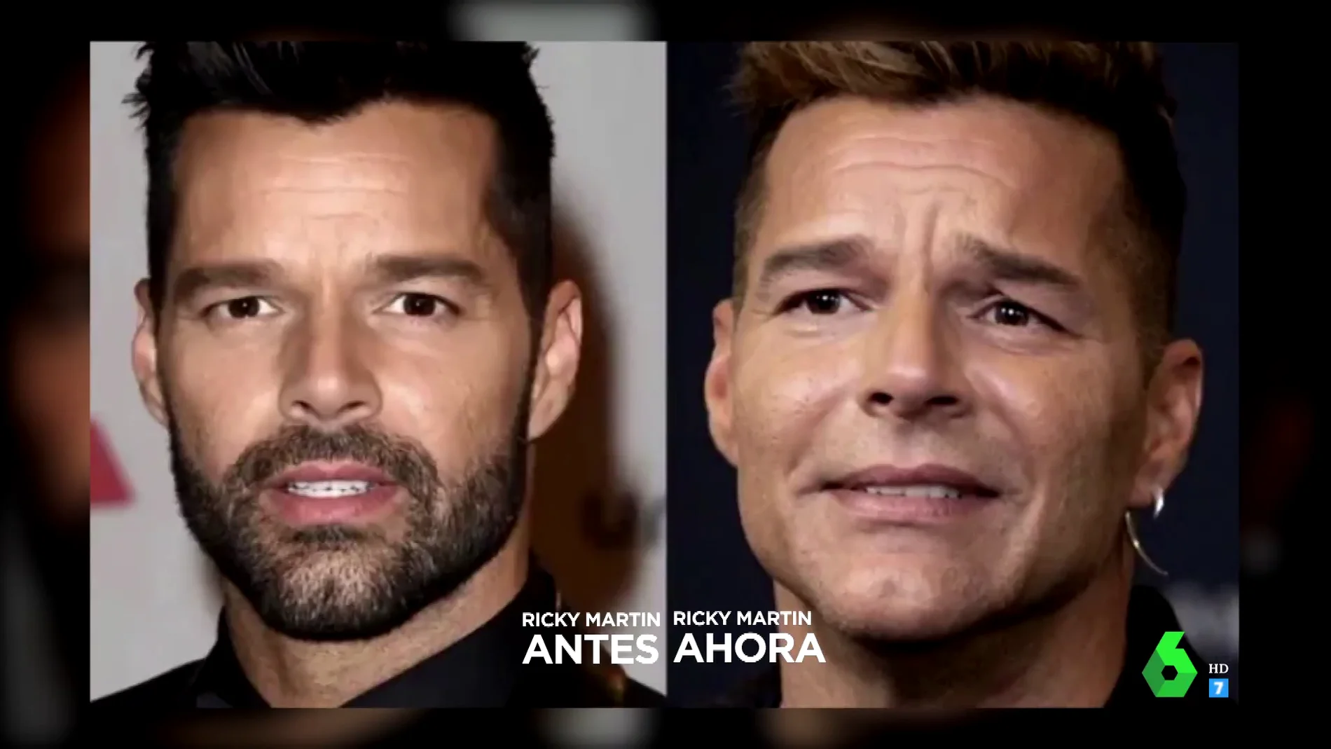 Ricky Martin explica lo que hay detrás de su cambio físico: "Creo que algunos de ustedes están muy preocupados"