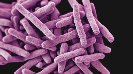 Mycobacterium tuberculosis, en una imagen 3D generada por ordenador Mycobacterium tuberculosis, en una imagen 3D generada por ordenador
