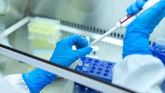 Pruebas en laboratorio Pruebas en laboratorio