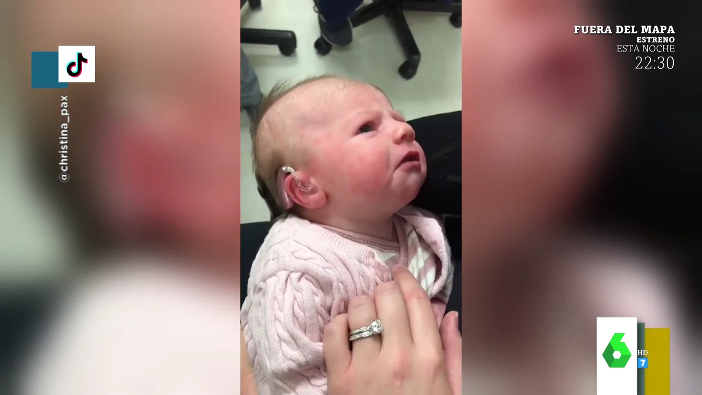 La emotiva reacción de un bebé al escuchar por primera vez la voz de su madre tras recibir un implante coclear La emotiva reacción de un bebé al escuchar por primera vez la voz de su madre tras recibir un implante coclear