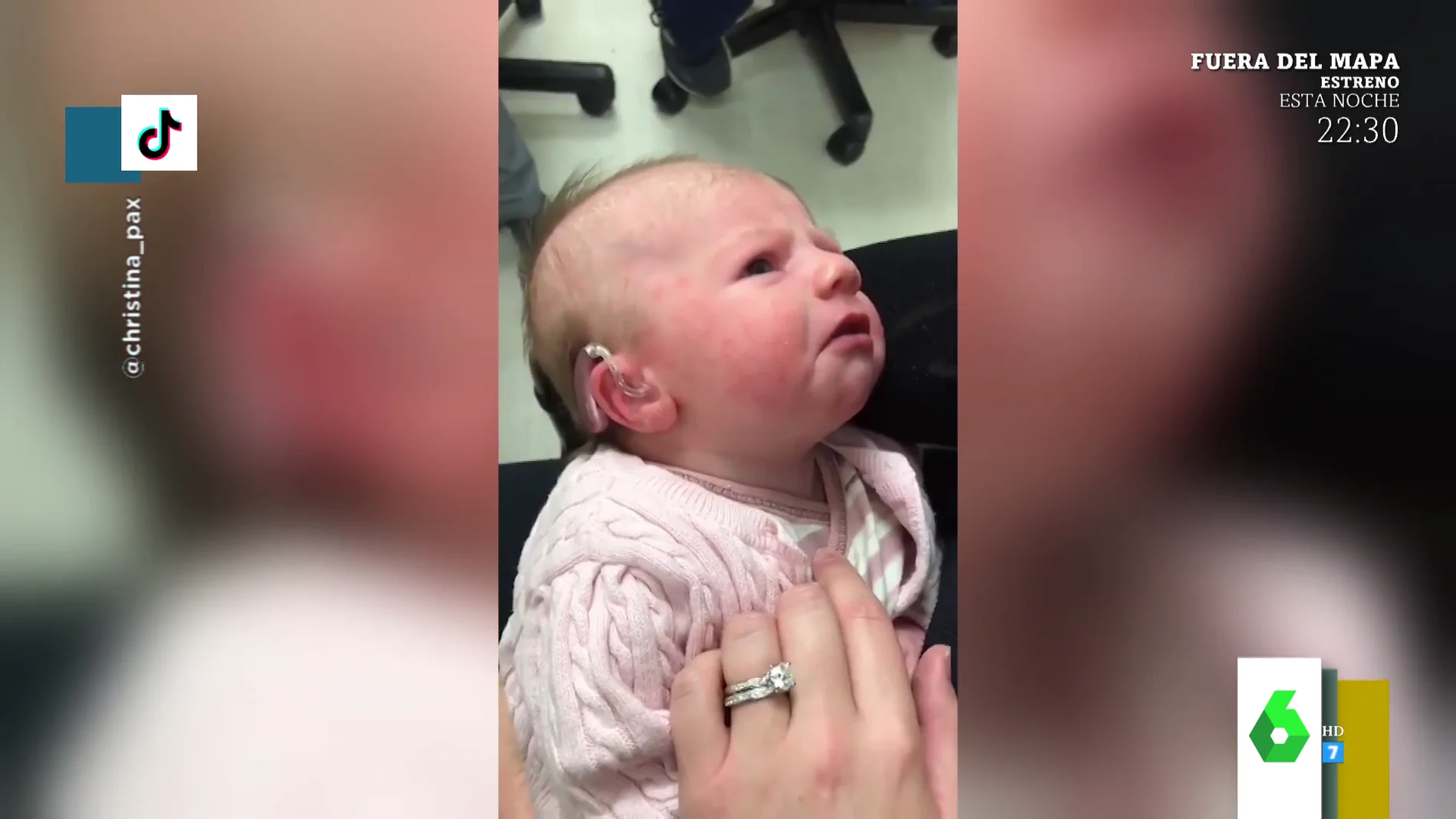 La emotiva reacción de un bebé al escuchar por primera vez la voz de su madre tras recibir un implante coclear