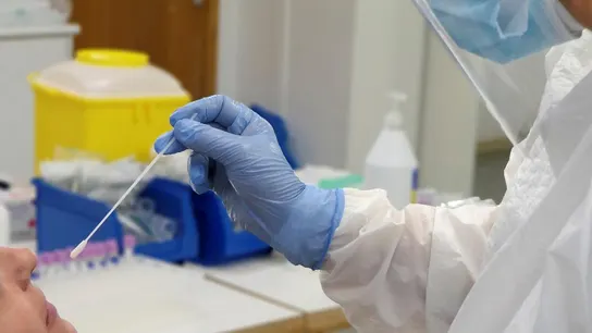 Imagen prueba PCR Imagen prueba PCR
