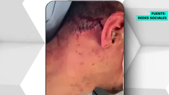Agresión homófoba a un joven en Oviedo Agresión homófoba a un joven en Oviedo
