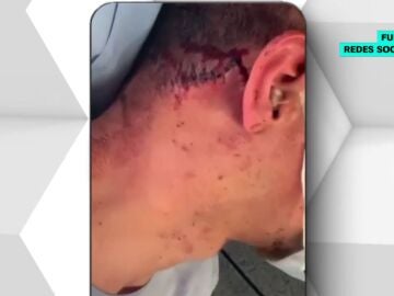 Agresión homófoba a un joven en Oviedo