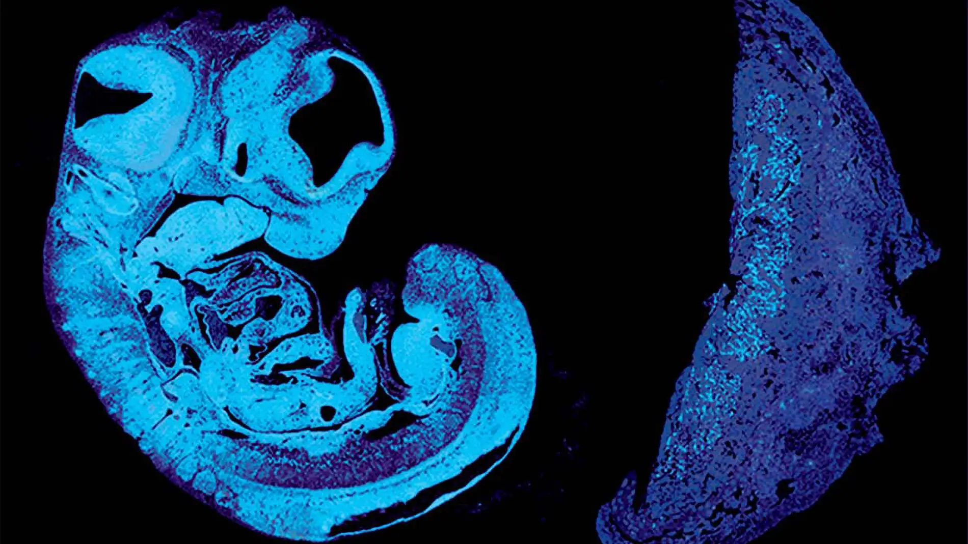 Sección de un feto de ratón y la placenta