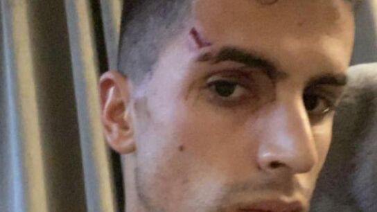 Joao Cancelo