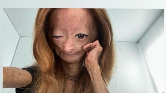 Adalia Rose Williams, en una foto subida en su cuenta de Instagram