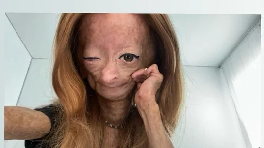 Adalia Rose Williams, en una foto subida en su cuenta de Instagram Adalia Rose Williams, en una foto subida en su cuenta de Instagram