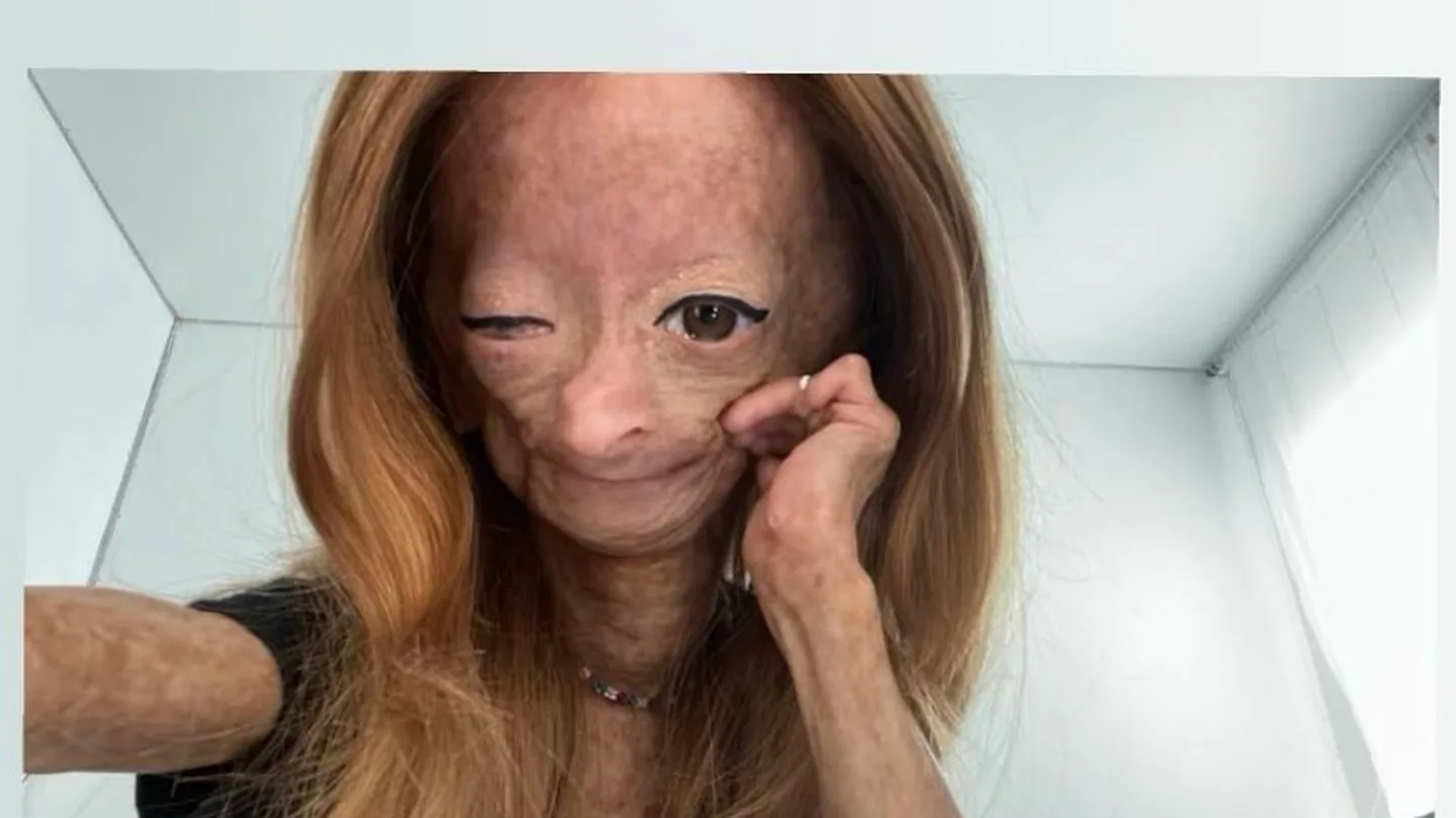 Adalia Rose Williams, en una foto subida en su cuenta de Instagram Adalia Rose Williams, en una foto subida en su cuenta de Instagram