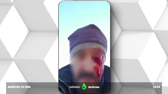 golpeado por cazadores golpeado por cazadores