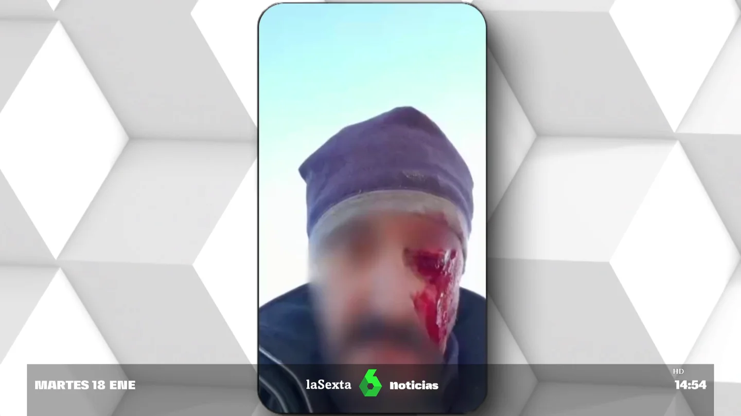 golpeado por cazadores golpeado por cazadores