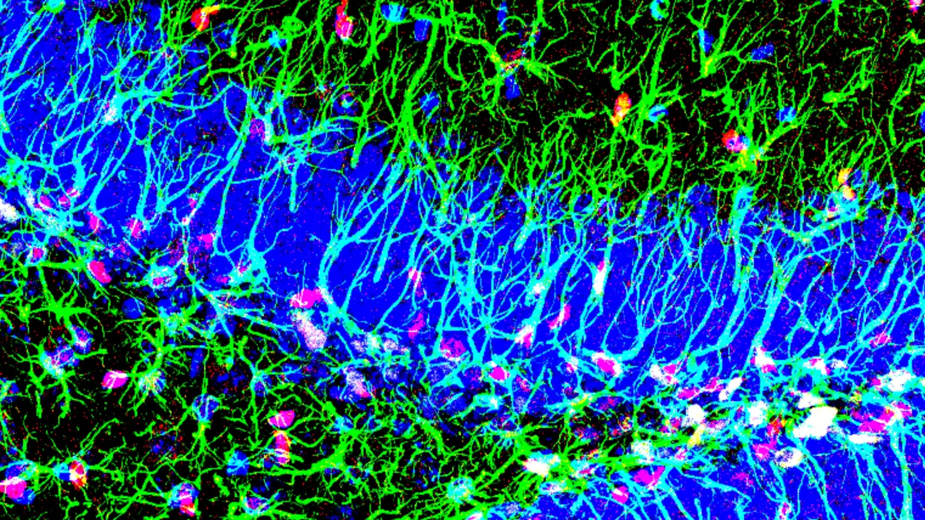 Descubierto un nuevo mecanismo para activar las celulas madre del cerebro adulto