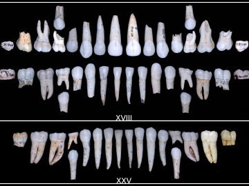 Imagen de dientes fosilizados