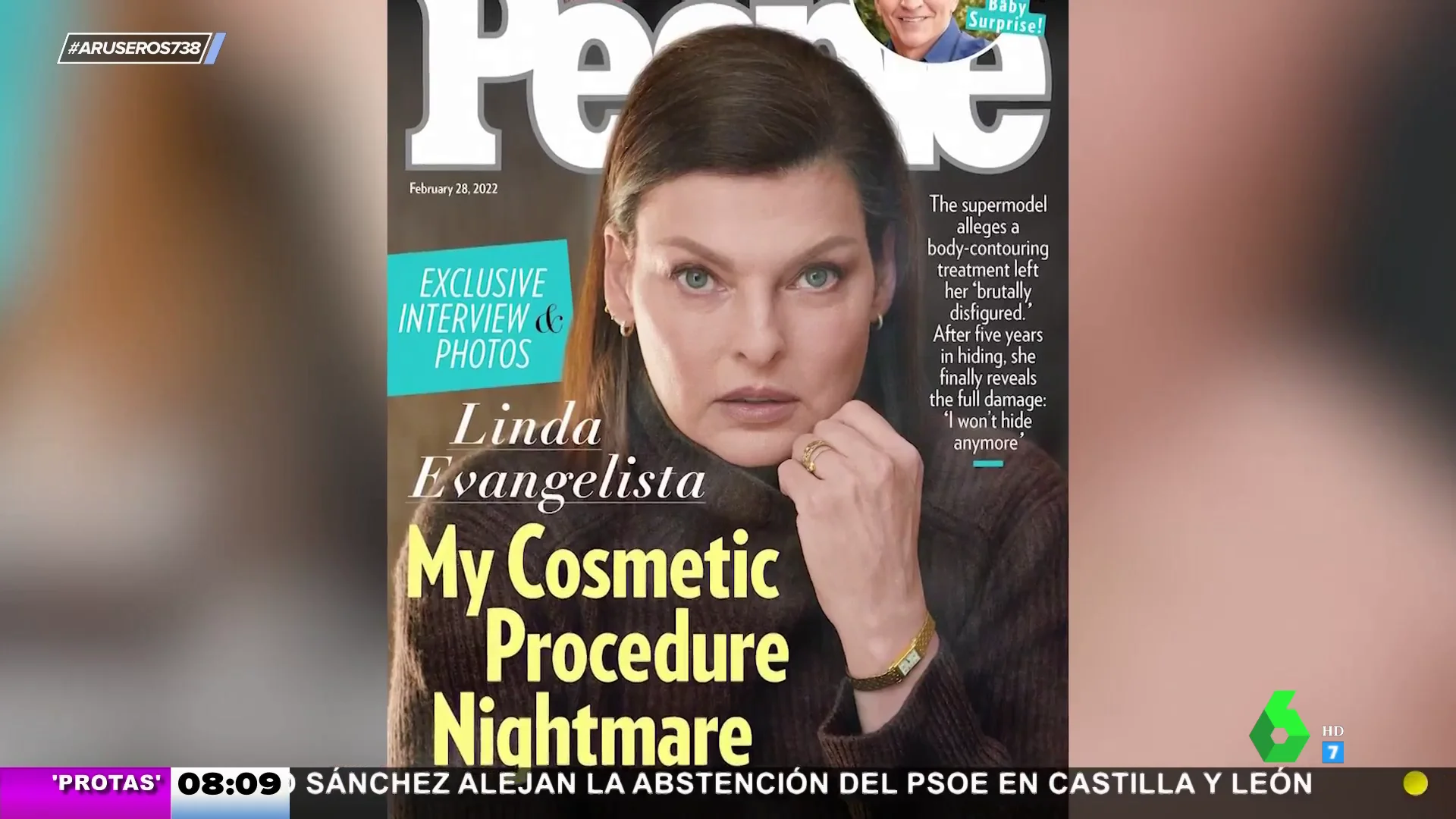 Linda Evangelista lipoescultura