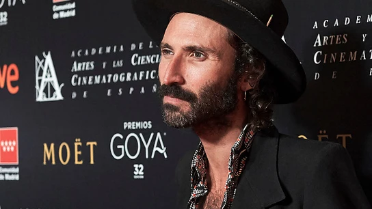 ¿Por qué Leiva tiene un ojo de cristal? ¿Por qué Leiva tiene un ojo de cristal?