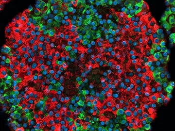 Crean por primera vez celulas beta pancreaticas funcionales a partir de celulas madre Crean por primera vez celulas beta pancreaticas funcionales a partir de celulas madre