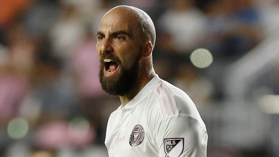 Gonzalo Higuaín Gonzalo Higuaín