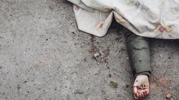 El cuerpo de una de las personas muertas en el bombardeo ruso en Irpín (Rusia)
