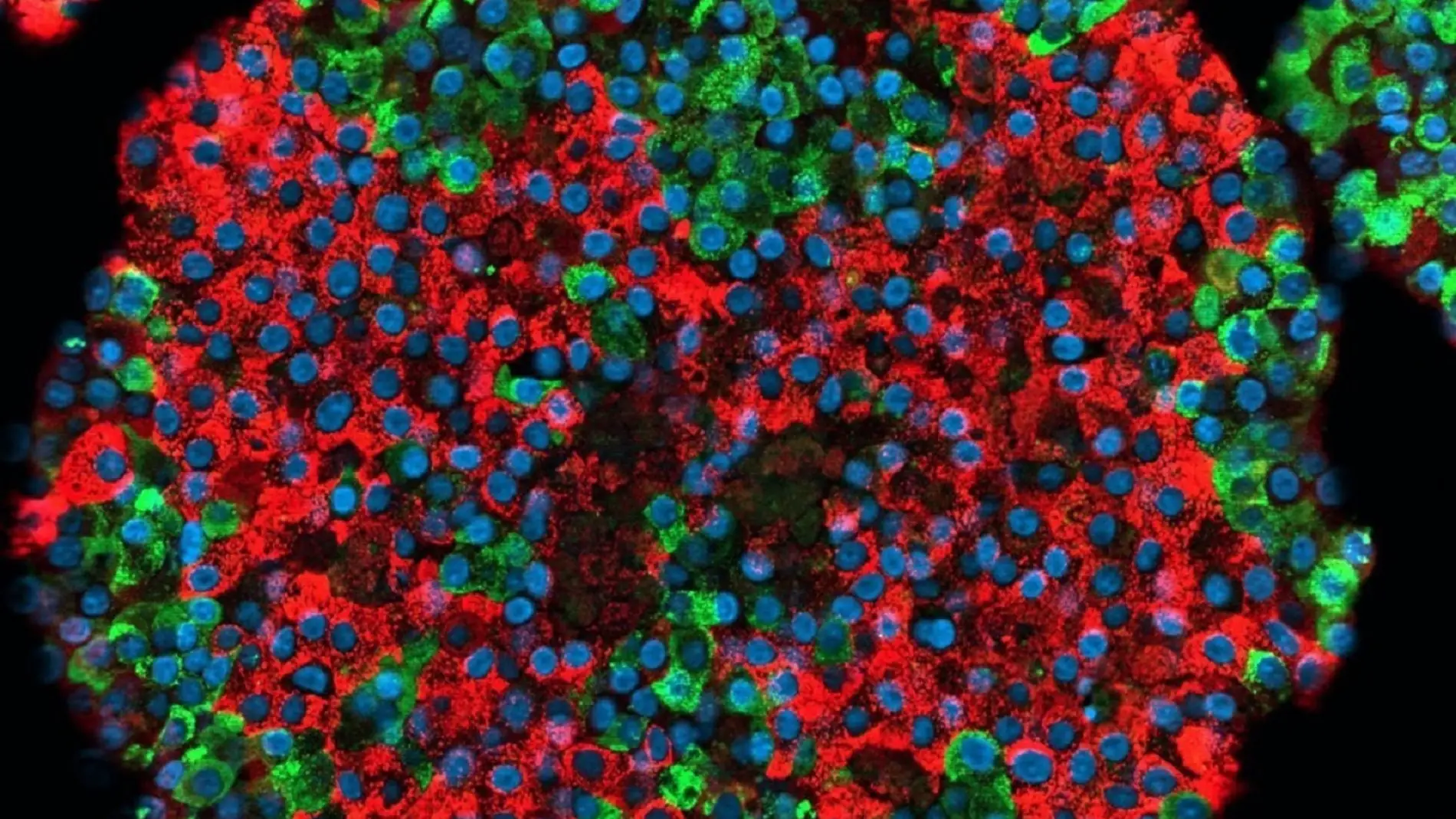 Crean por primera vez celulas beta pancreaticas funcionales a partir de celulas madre
