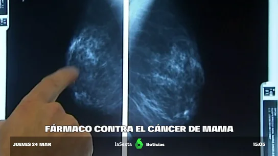 Nuevo fármaco contra el cáncer de mama Nuevo fármaco contra el cáncer de mama