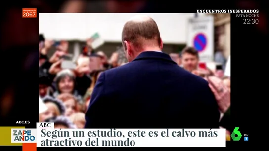 calvo calvo