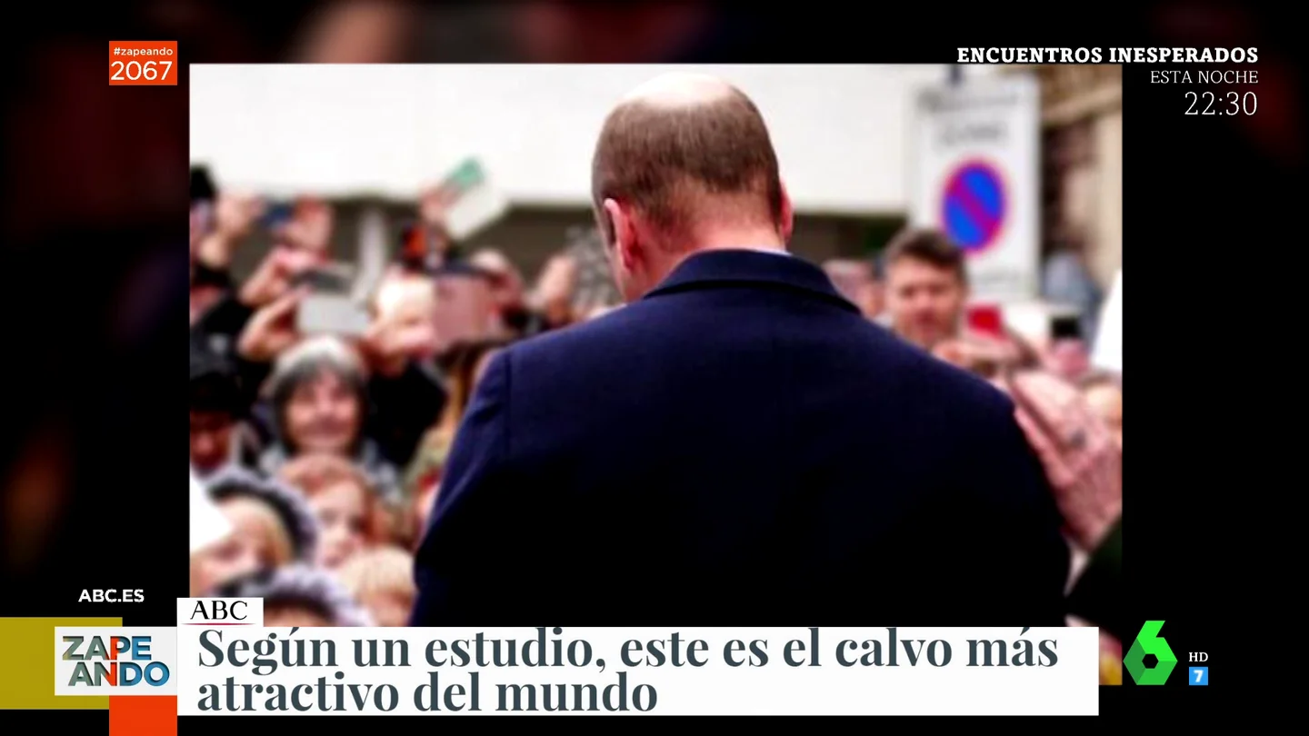 calvo calvo