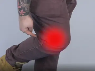 Dolor en la rodilla Dolor en la rodilla