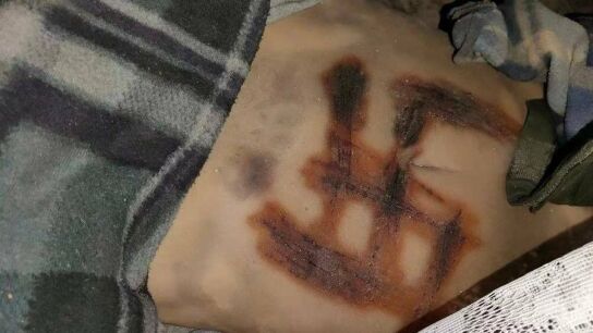 Una diputada ucraniana denuncia que las tropas rusas violaron y torturaron hasta la muerte a una joven a la que grabaron una esv&aacute;stica en el torso
