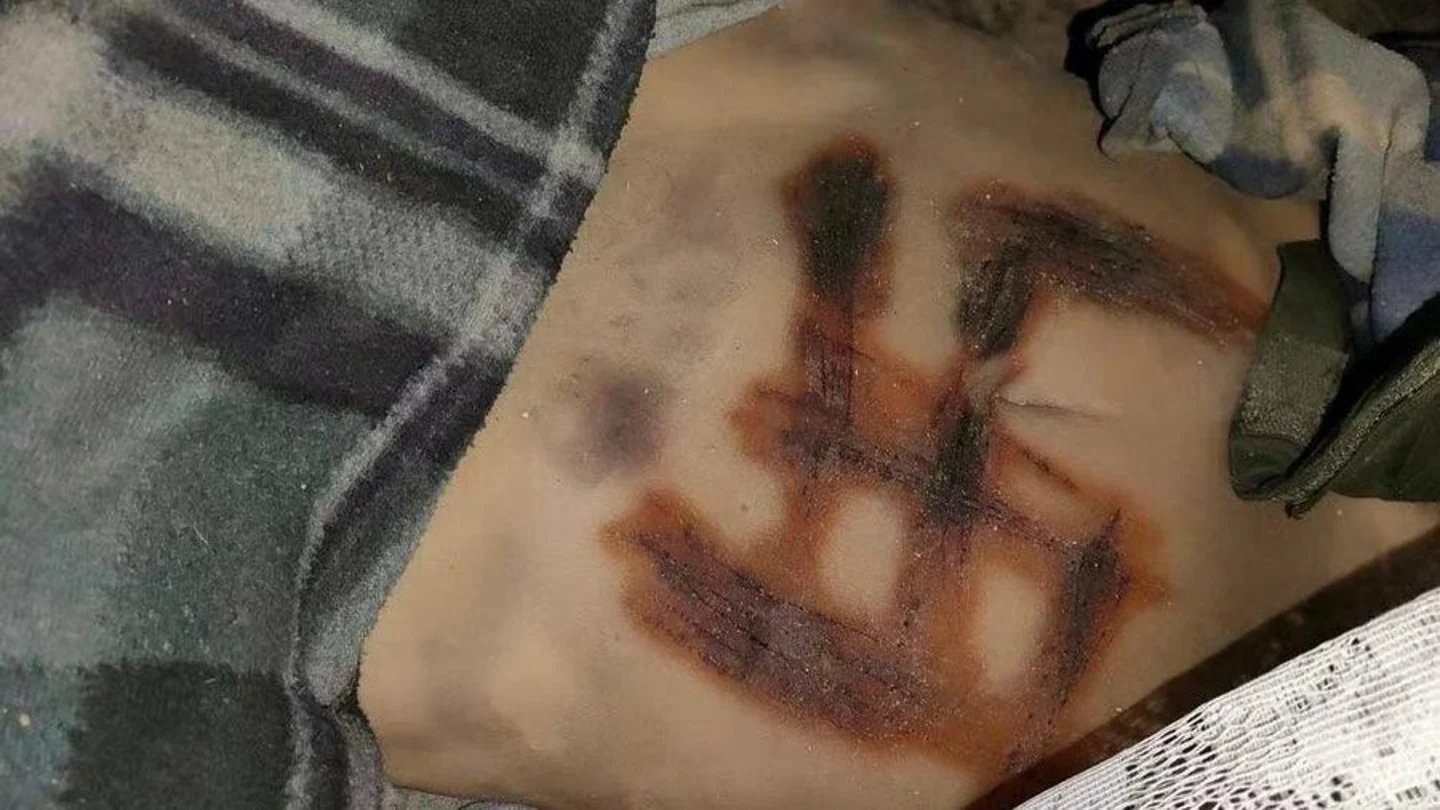 Una diputada ucraniana denuncia que las tropas rusas violaron y torturaron hasta la muerte a una joven a la que grabaron una esvástica en el torso Una diputada ucraniana denuncia que las tropas rusas violaron y torturaron hasta la muerte a una joven a la que grabaron una esvástica en el torso
