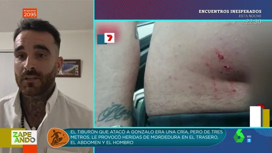 Gonzalo Mompó cuenta cómo ha sobrevivido al ataque de un tiburón blanco en Australia: "Miré si la pierna estaba ahí" Gonzalo Mompó, tras ser atacado por un tiburón blanco en Australia: "Miré si la pierna estaba ahí"