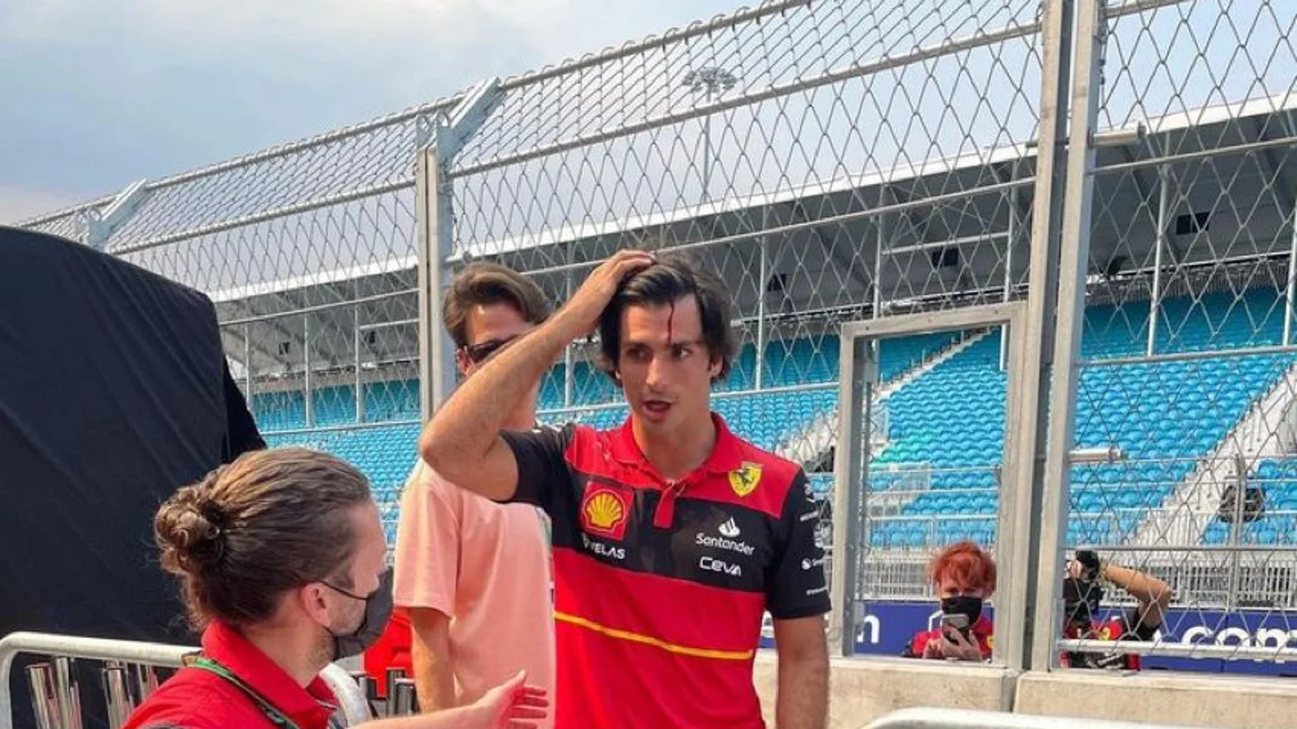 La brecha de Sainz tras golpearse la cabeza La brecha de Sainz tras golpearse la cabeza