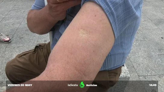 Todos los nacidos antes de 1970 tienen puesta la vacuna contra la viruela casi con total seguridad Todos los nacidos antes de 1970 tienen puesta la vacuna contra la viruela casi con total seguridad