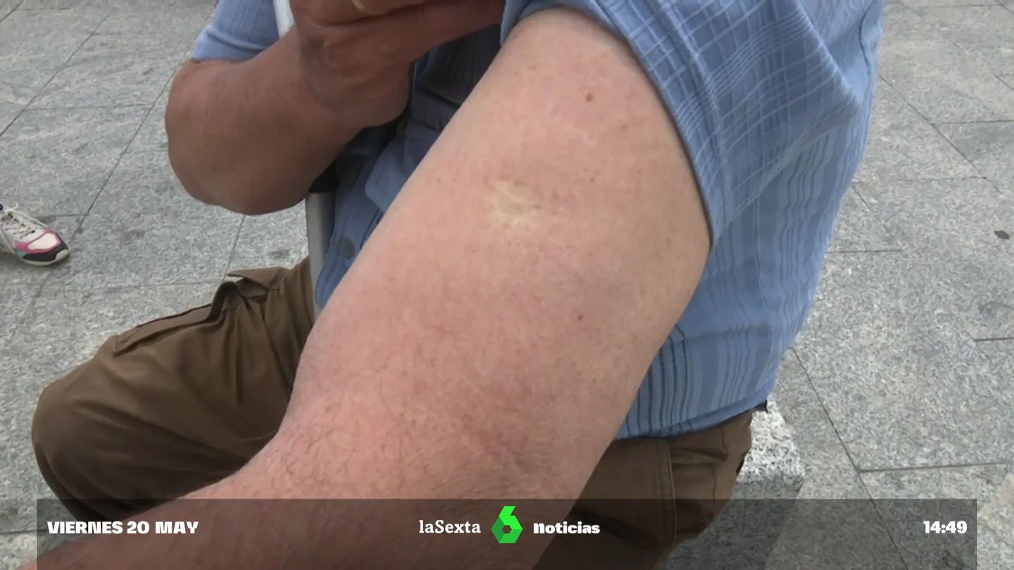 Todos los nacidos antes de 1970 tienen puesta la vacuna contra la viruela casi con total seguridad Todos los nacidos antes de 1970 tienen puesta la vacuna contra la viruela casi con total seguridad