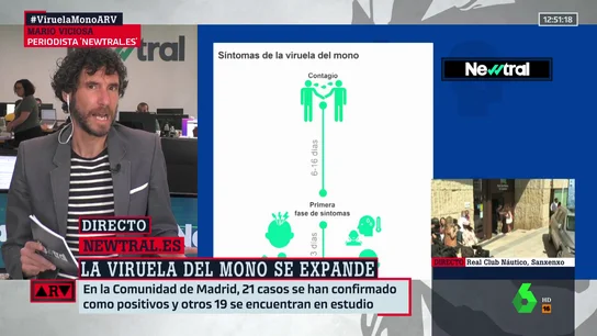 ViciosaARV ViciosaARV