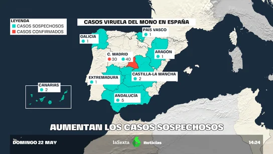 Aragón confirma su primer caso sospechoso de viruela del mono Aragón confirma su primer caso sospechoso de viruela del mono
